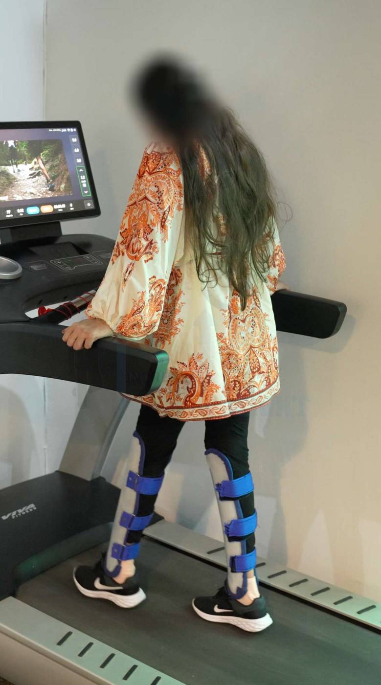 Limb Lengthening in India: Height Increase Info